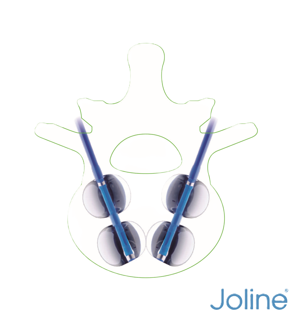 Joline®